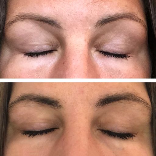 Eyebrow Enhancing Serum 5 ml. - Billede 7