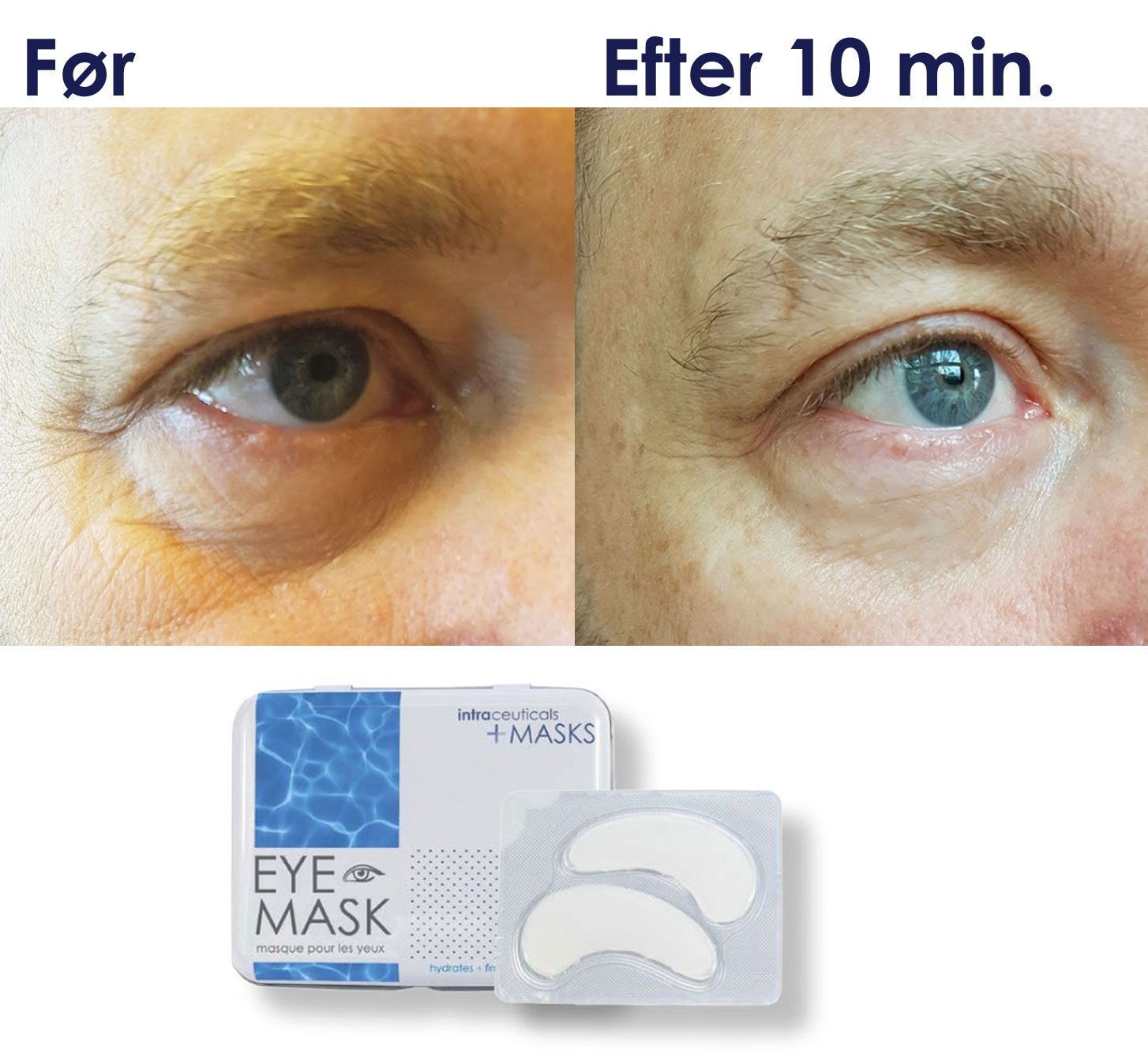 Rejuvenate Eye Mask - Billede 3