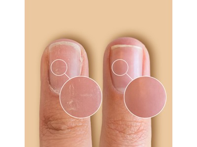 SolarOil Nail & Cuticle Treatment - Billede 5